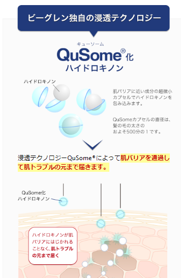 ビーグレンで肝斑が消える？ハイドロキノンの効果を検証してみた！